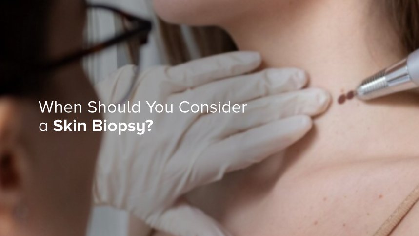 When Should You Consider a Skin Biopsy?